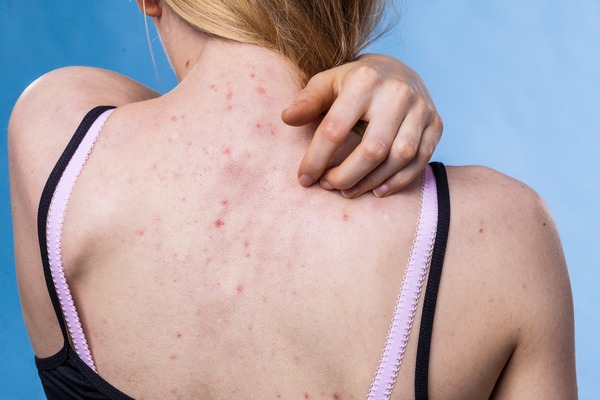 Esthéticienne pour peeling du corps, Antibes, BA Centre Esthétique