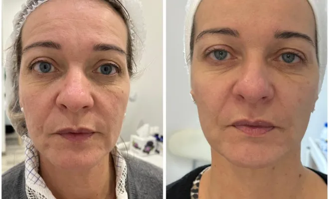 ba centre esthetique