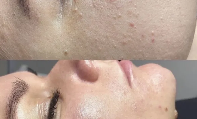 Nettoyage de peau + gommage + masque alginate, Antibes, BA Centre Esthétique